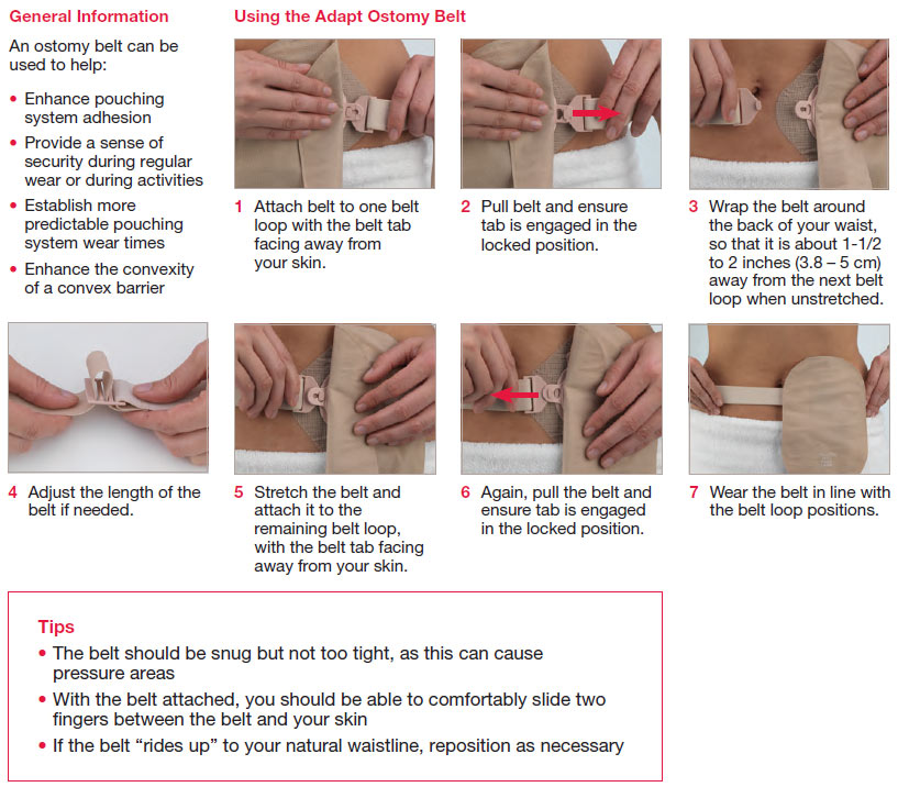 เข็มขัดรัดถุงอุจจาระ ปัสสาวะหน้าท้อง (Convatec Ostomy belt)