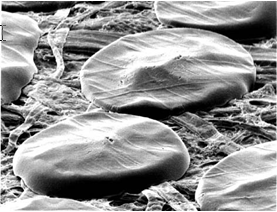 SEM photograph of phase-change ink 