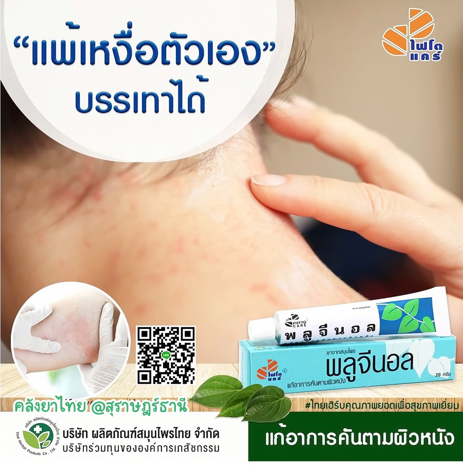 พลูจีนอล ครีมแก้ลมพิษ ผื่นคัน ผิวอักเสบ