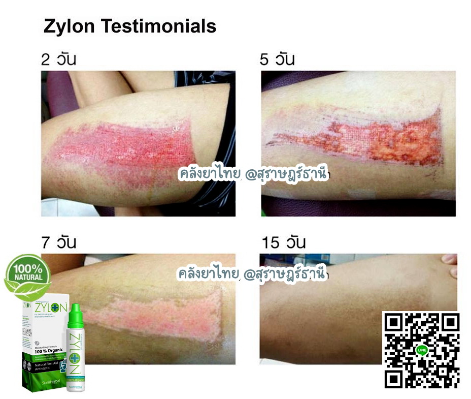 Zylonไซล่อน สมานแผลเร็ว ไม่แสบ