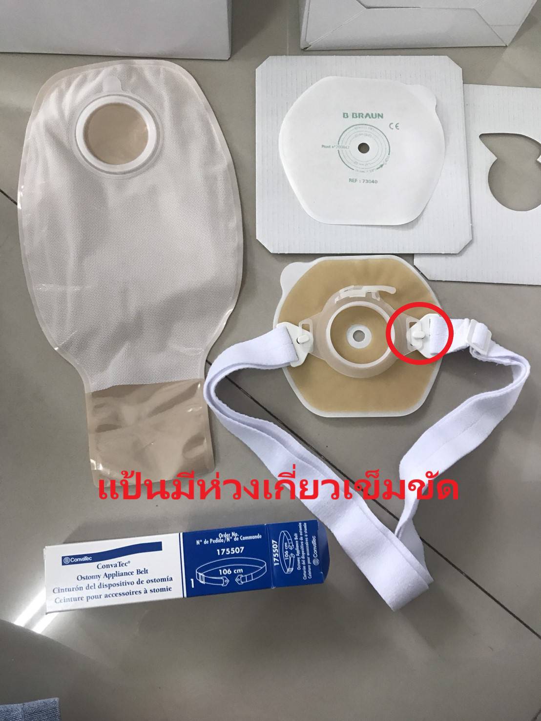 เข็มขัดรัดถุงอุจจาระ ปัสสาวะหน้าท้อง (Convatec Ostomy belt)