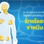 ยาแก้น้ำเหลืองเสีย
